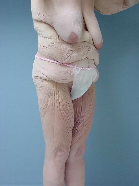 Older grannies and matures showing their wrinkled bodies - part 776